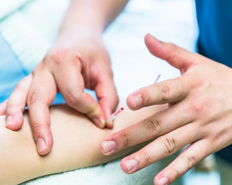 【上半身へのアプローチ】はり治療・灸治療の写真3