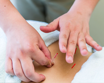 【腰部・臀部へのアプローチ】はり治療・灸治療の写真1