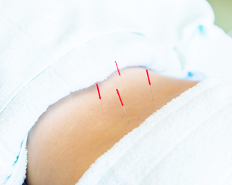 【腰部・臀部へのアプローチ】はり治療・灸治療の写真2