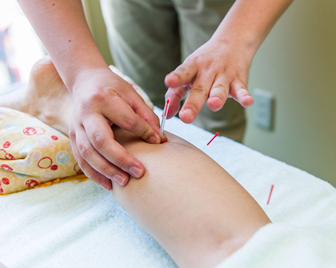 【下半身へのアプローチ】はり治療・灸治療の写真1